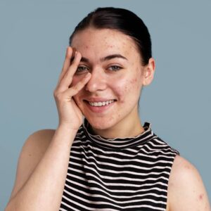 Before Advanced Headshot Retouching Services