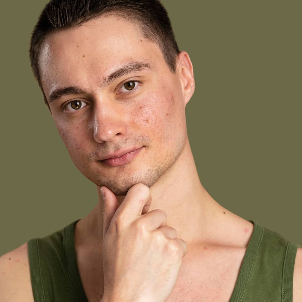 Before Basic Headshot Retouching