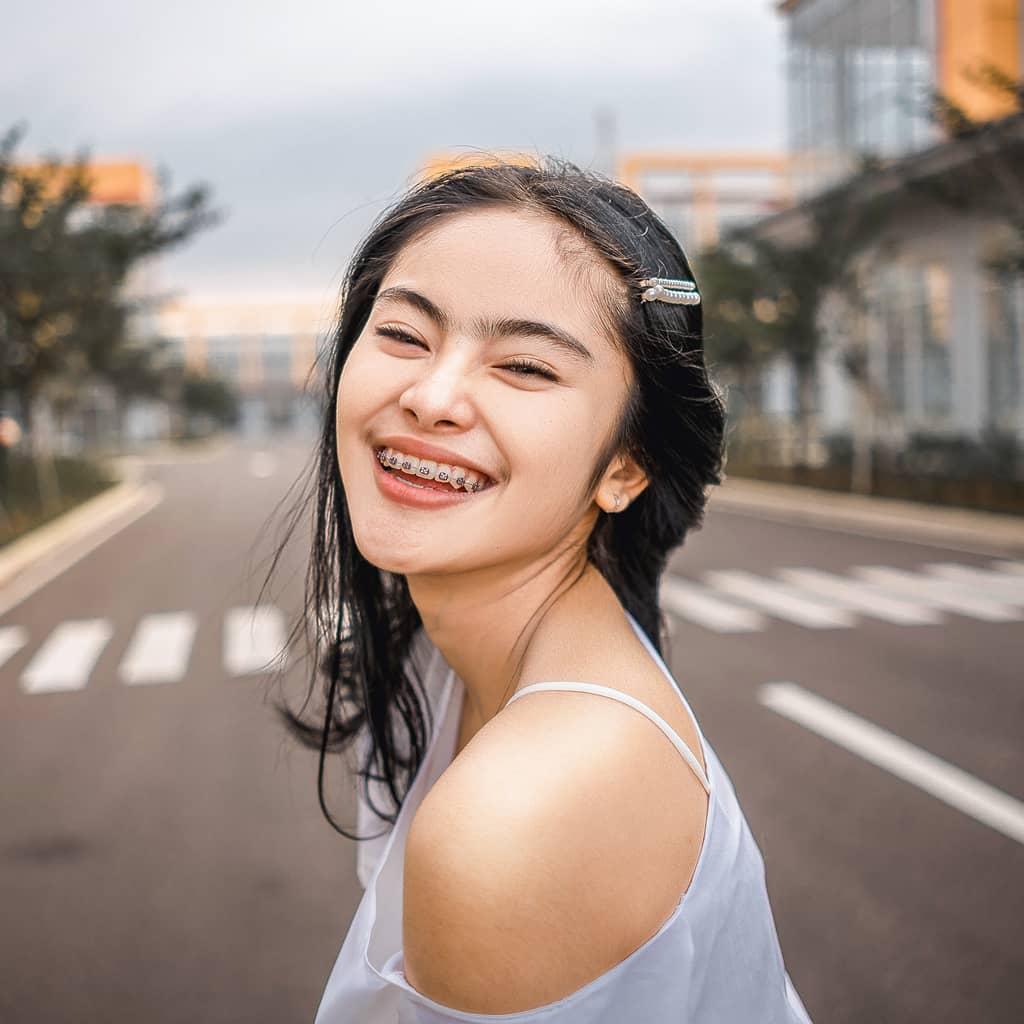 Before Braces Removal Services