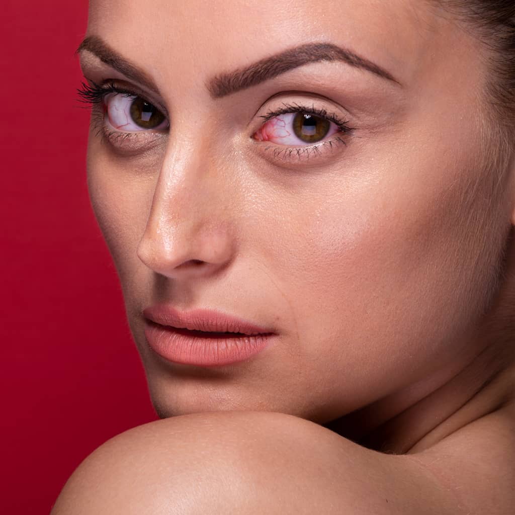 Before Eye Correction Services