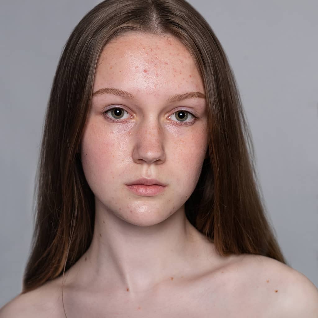 Before Skin Smoothing and Toning Services