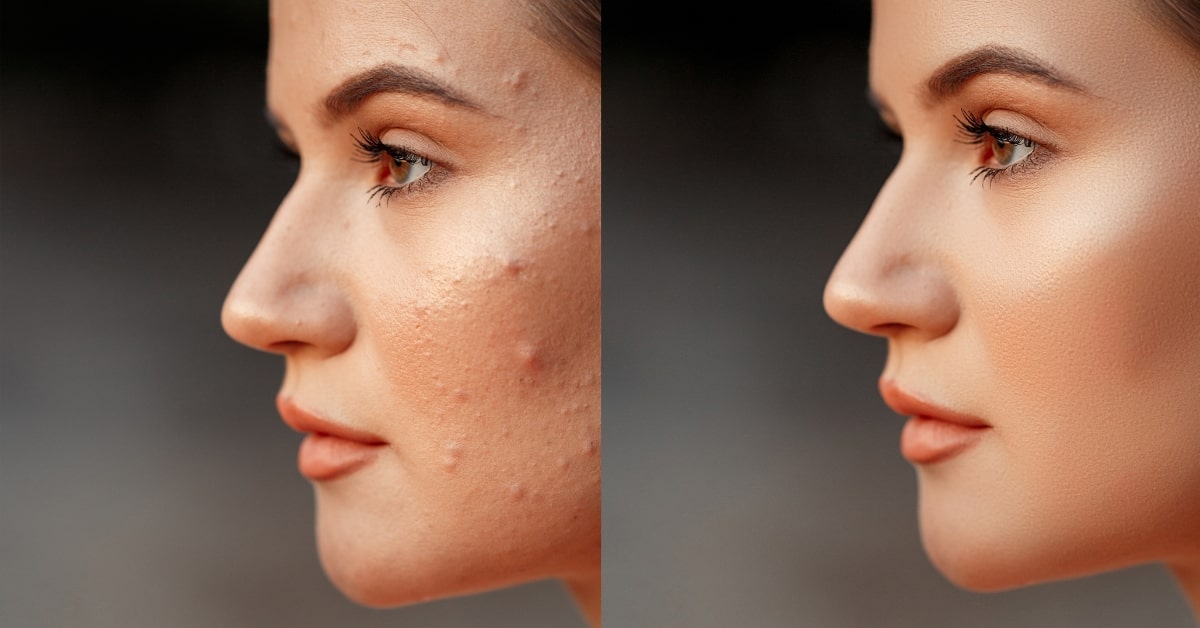High-End Photo Retouching Services
