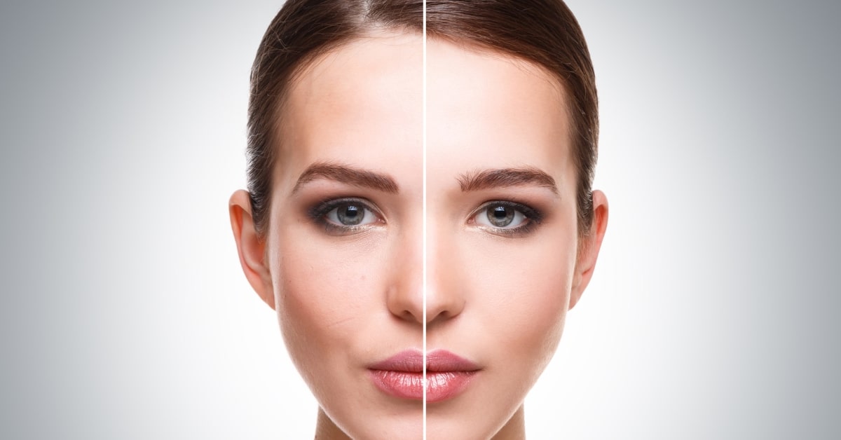 How to retouch skin in photoshop