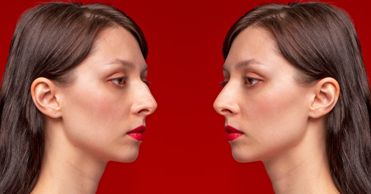 Photo Retouching Services