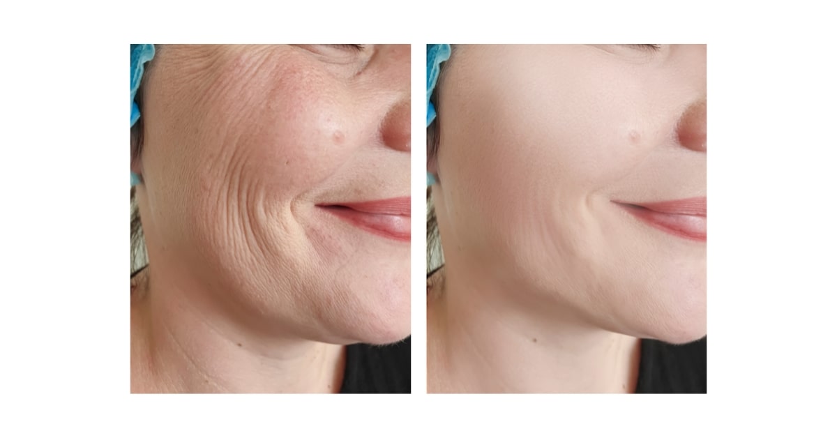 Extensive Retouching