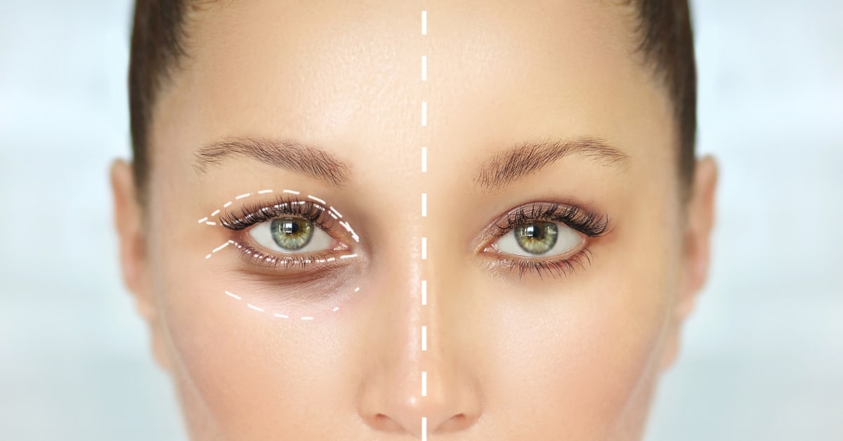 Online Retouching Services