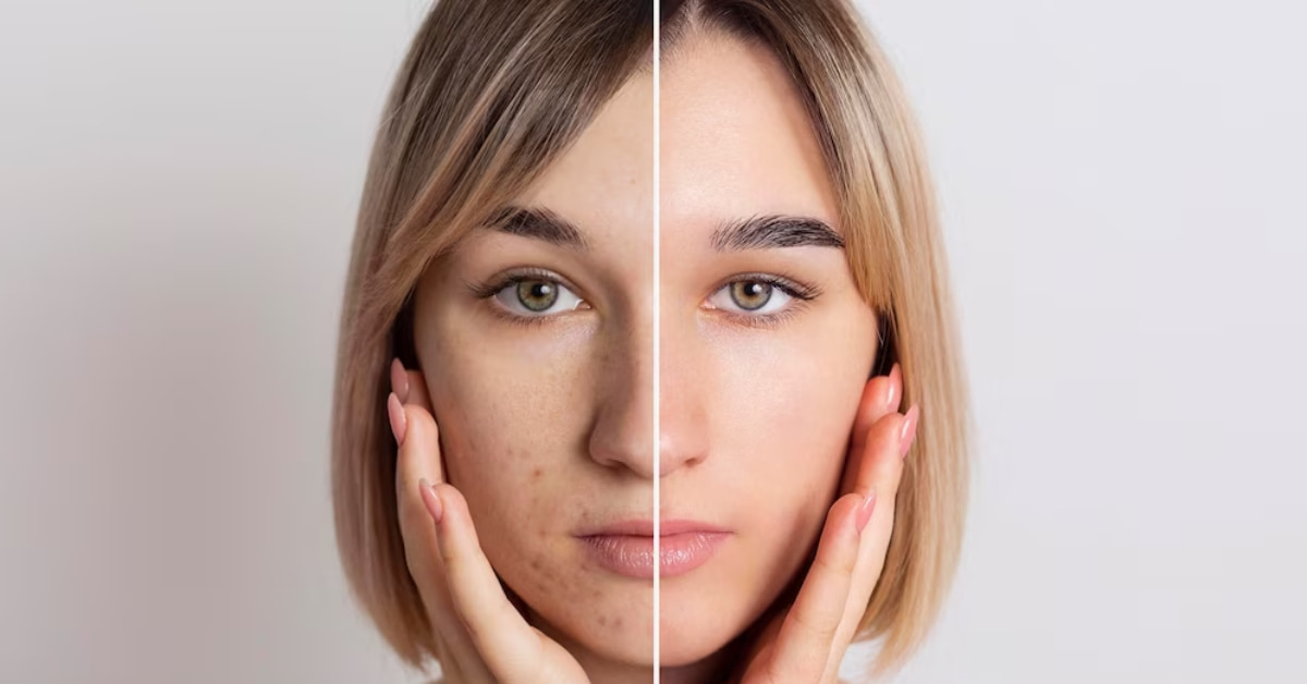Retouching Services