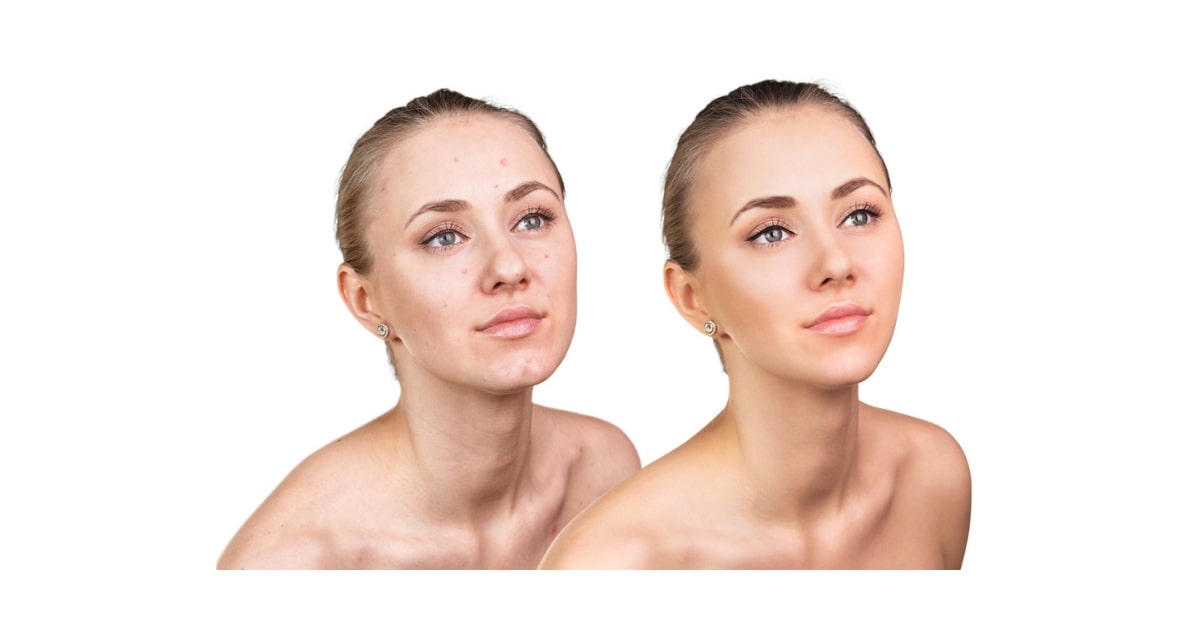 Skin Retouching Article