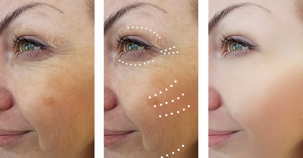 Skin Retouching in Lightroom