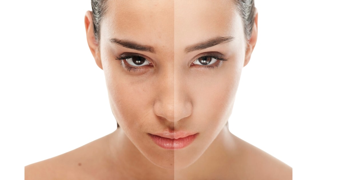 What is Beauty Retouching?