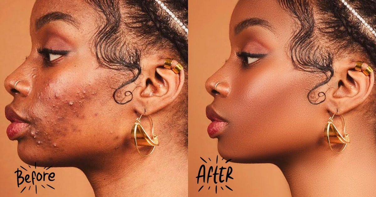 Exploring High-End Retouching