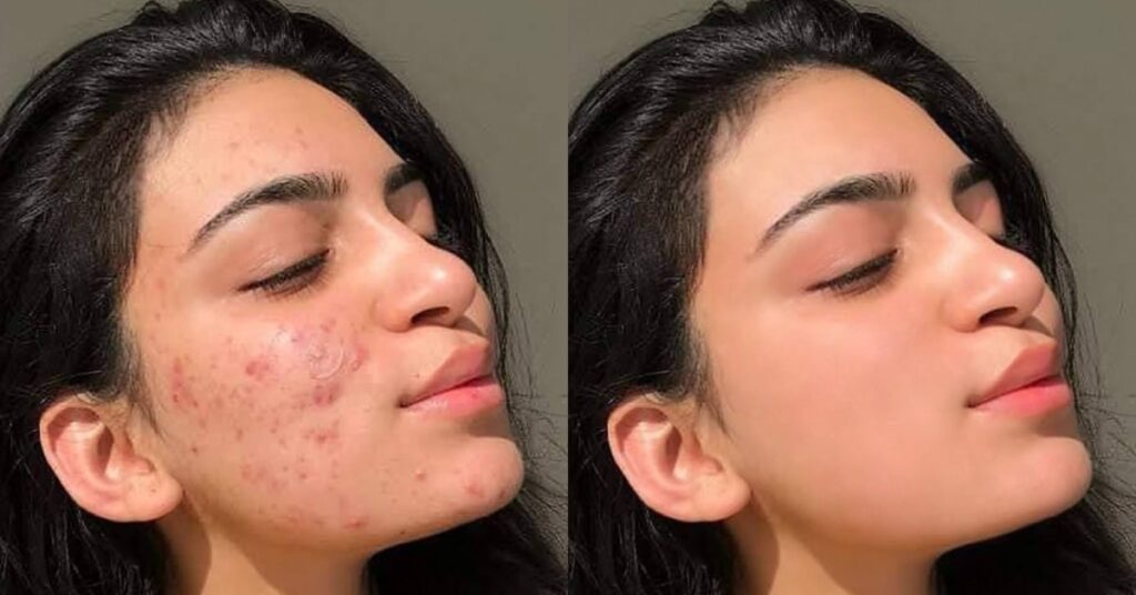 A Woman With Smooth Skin After Photo Retouching