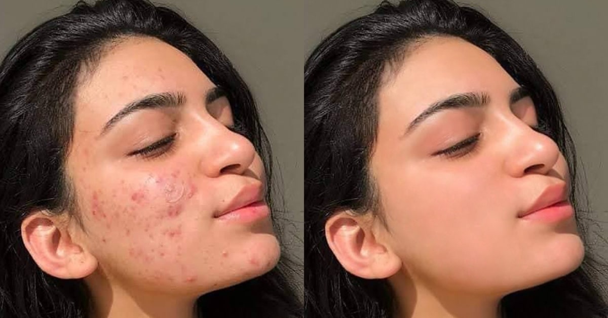 Photo Retouching