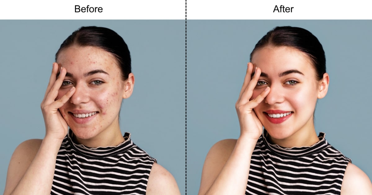 Photo Editing and Retouching