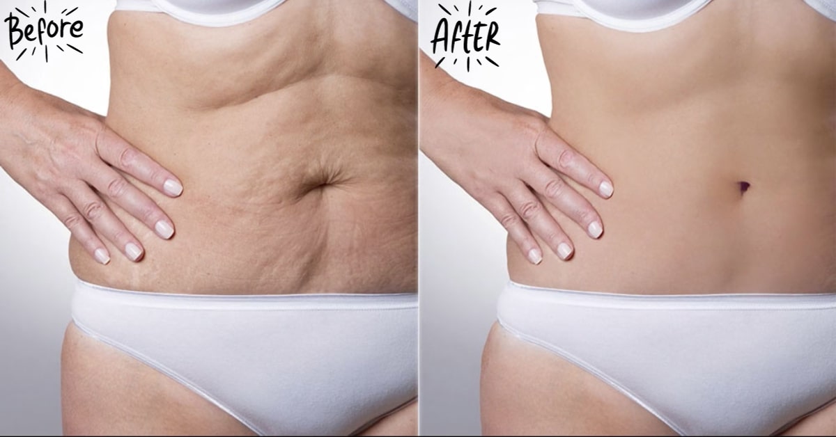 Body Retouching with GIMP