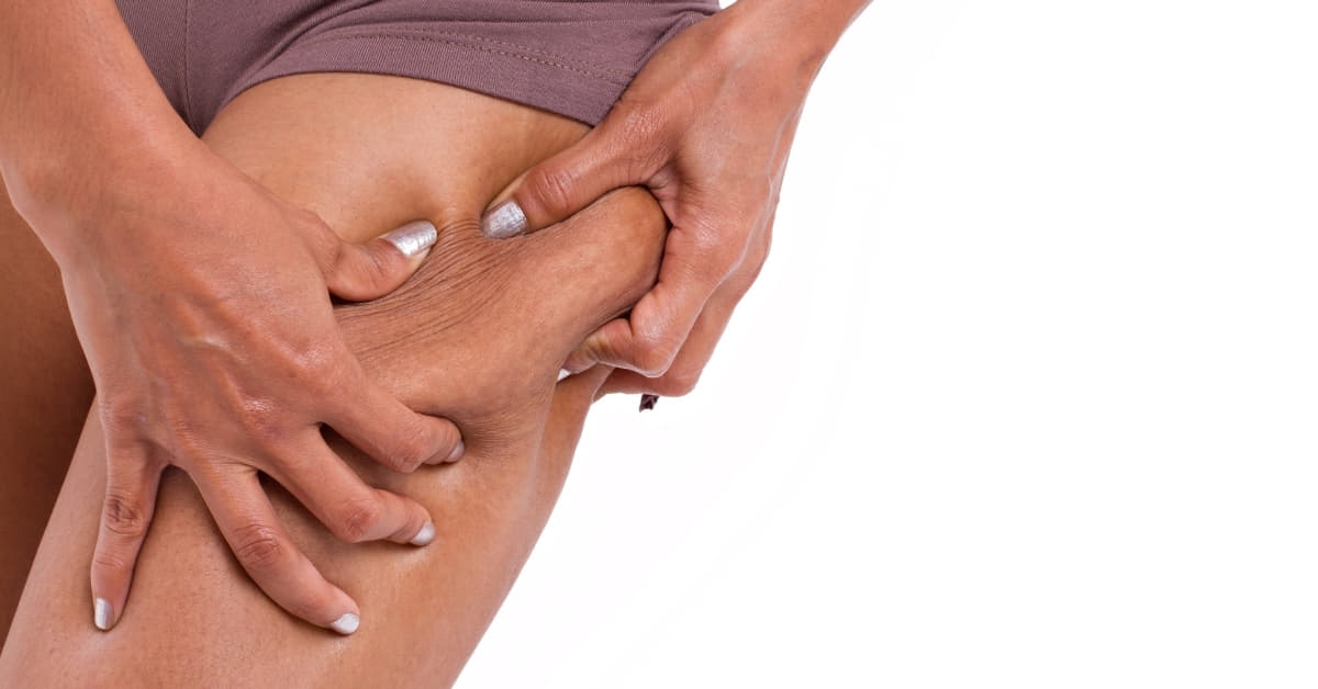How To Edit Cellulite In Pictures