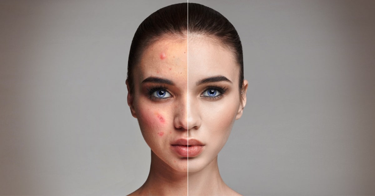 Image Post-Processing Services