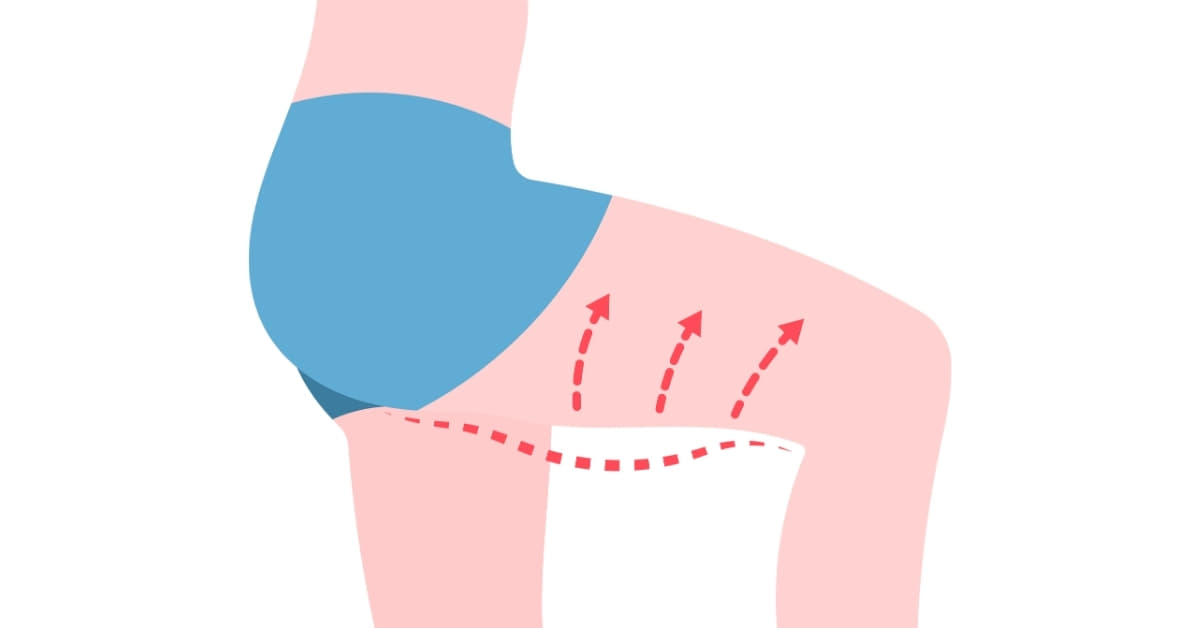 Reshape Body