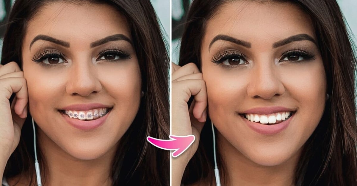 Photoshop Braces Off Apps