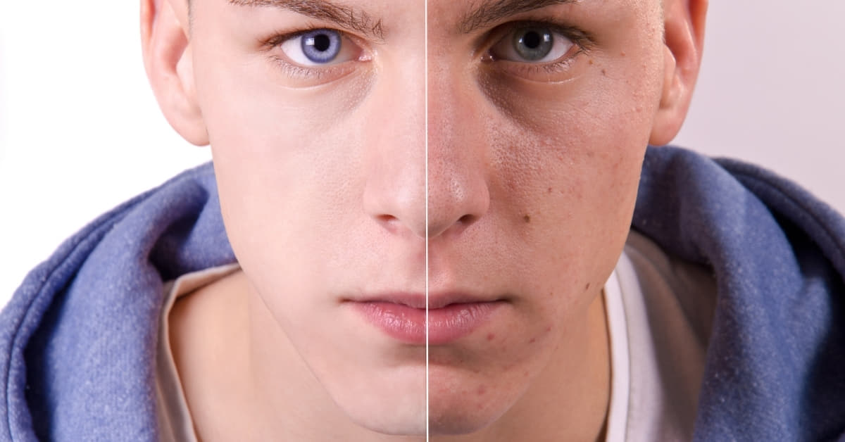 Retouch Photo