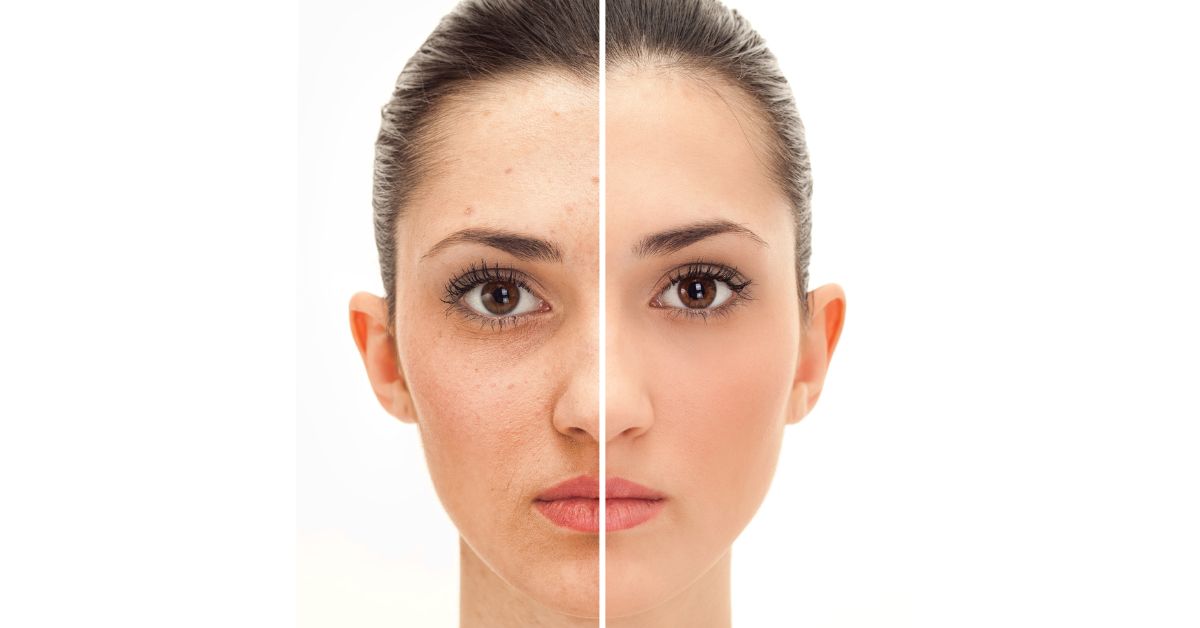 Define Retouching